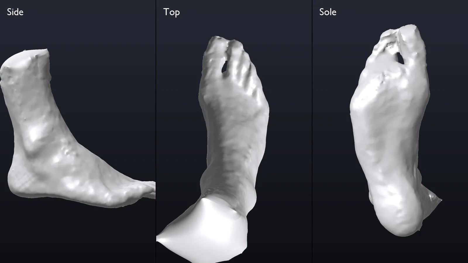 A foot scan seen from the side, from above and from below