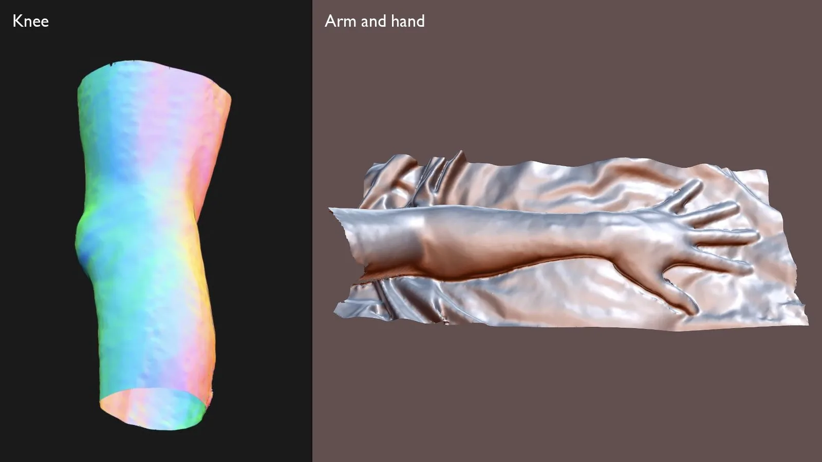 3D scans of a knee and of an arm and hand